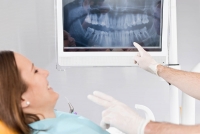 Zahnwurzelbehandlung - Endodontie